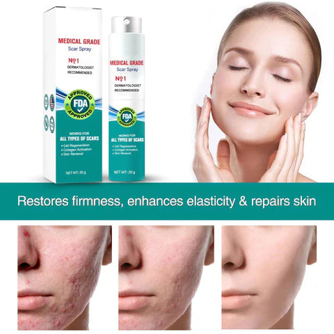 ️Advanced Scar Spray For All Types of Scars - For example Acne Scars ...