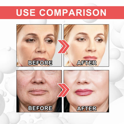 Last Day Promotion 70% OFF - 🔥2023 New Collagen Boost Permanent  Anti-Aging Serum